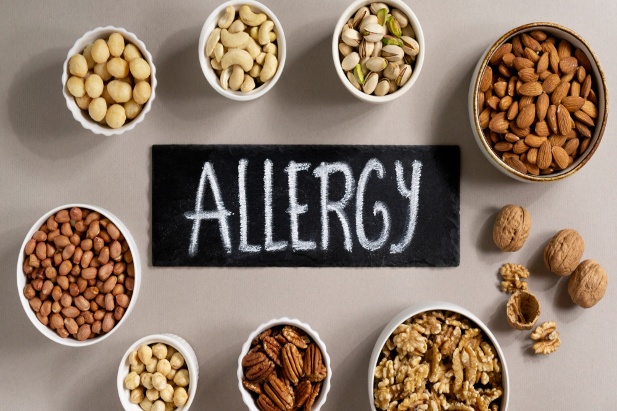 Can You Cure a Food Allergy?