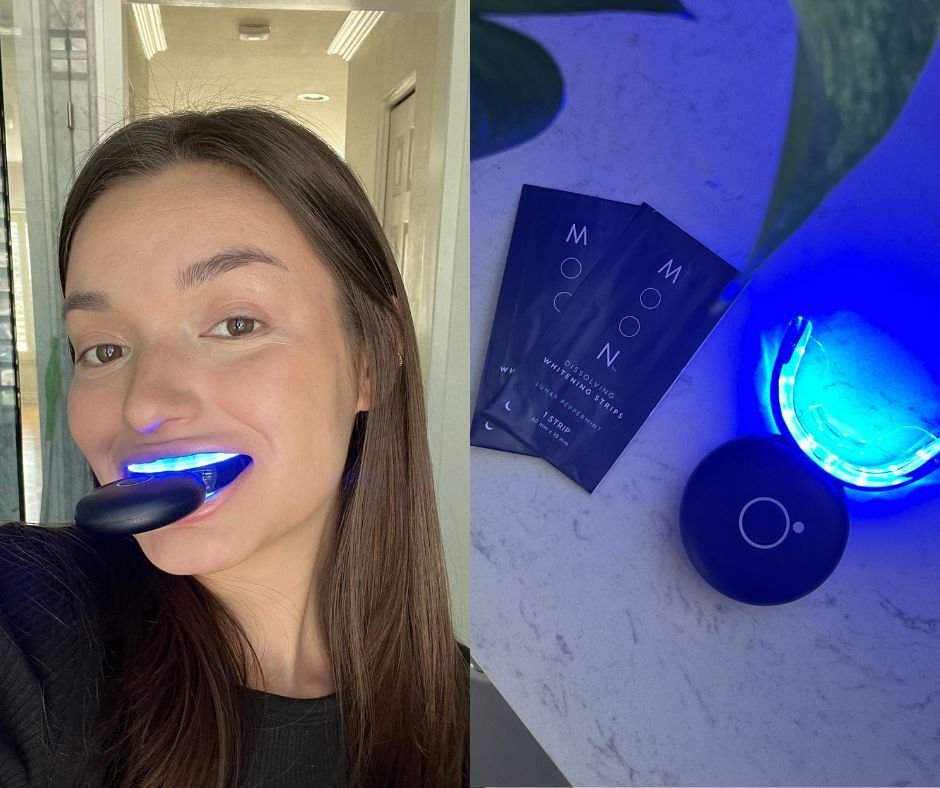 I Tried MOON’s Teeth Whitening Device – Here’s What Happened