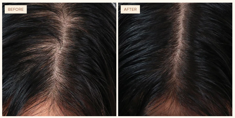 Vegamour before and after, scalp close-up